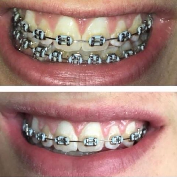 Whitening Toothpaste - Picture 4 of 16